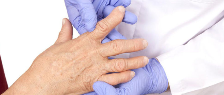 4 best remedies for rheumatoid arthritis 