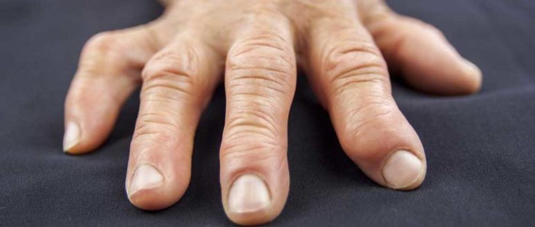 5 Causes of Swollen Fingers