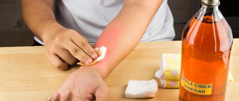 5 Easy Methods to Treat Bruises