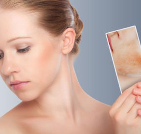 6 things you should not do if you have skin rash