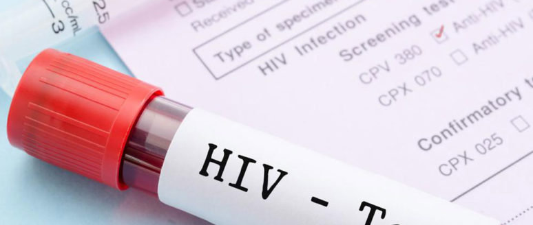 Common signs and symptoms of HIV