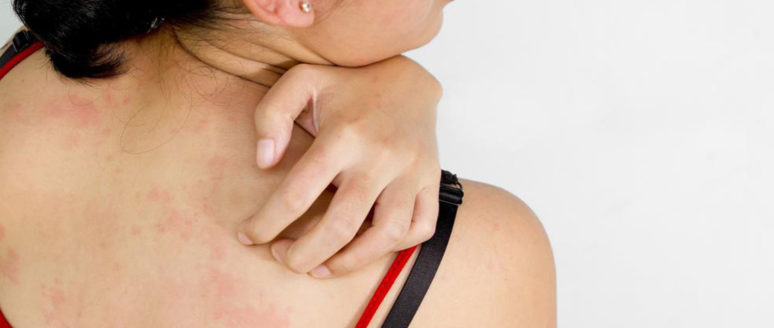 Here are a few common causes of itchy skin