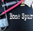 Prevention and Treatment for Bone Spurs