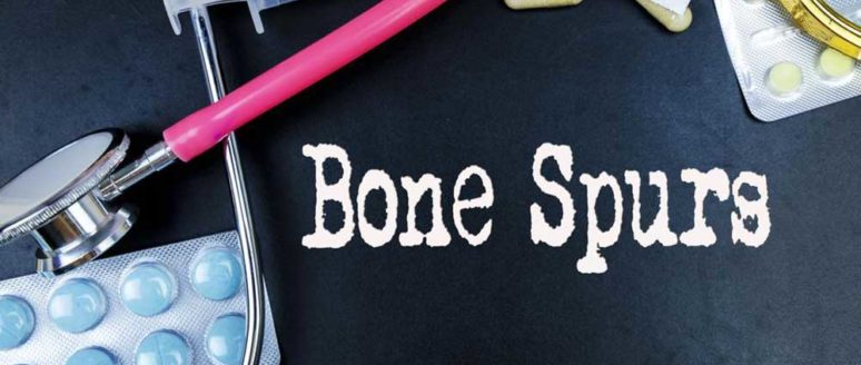 Prevention and Treatment for Bone Spurs