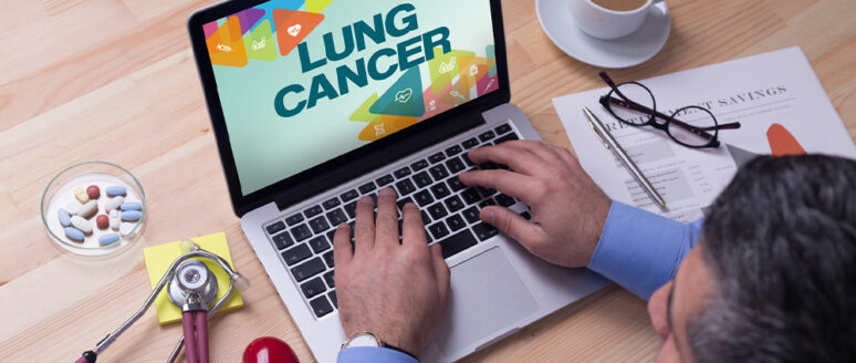 3 tips to manage lung cancer