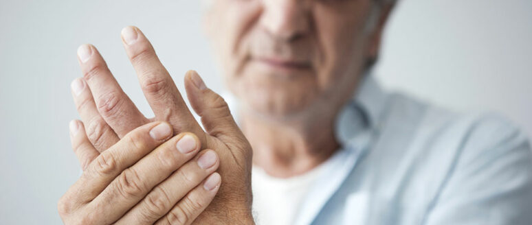 Arthritis – Types, signs and risk factors
