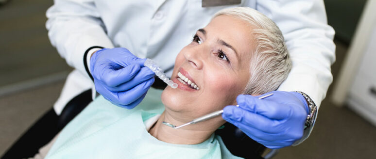 Dental implants – Components, types, and benefits